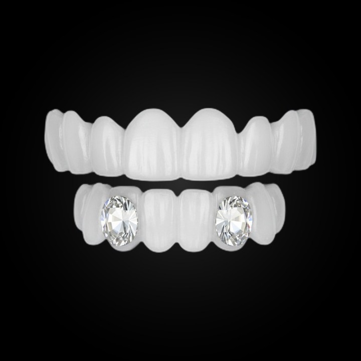 Grillz Élégance_ silver - 1