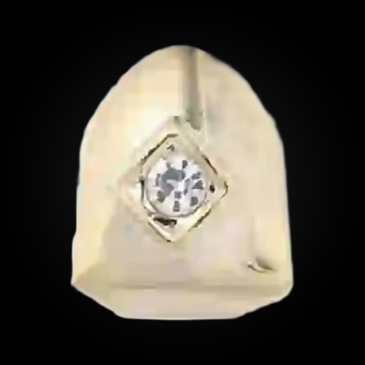 Grillz singolo dente oro - cap con un cristallo