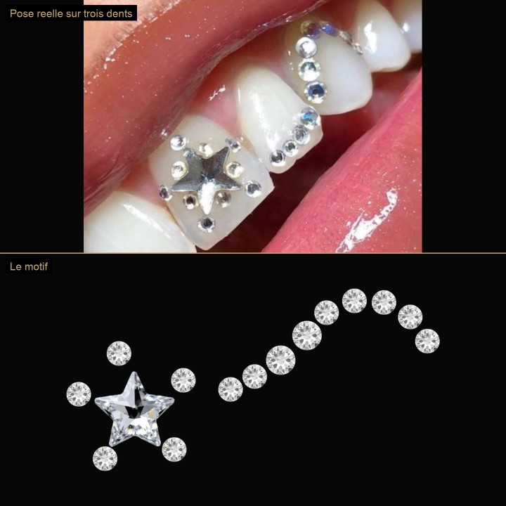 Grande étoile filante - motif 15 pierres | Strass Dentaires
