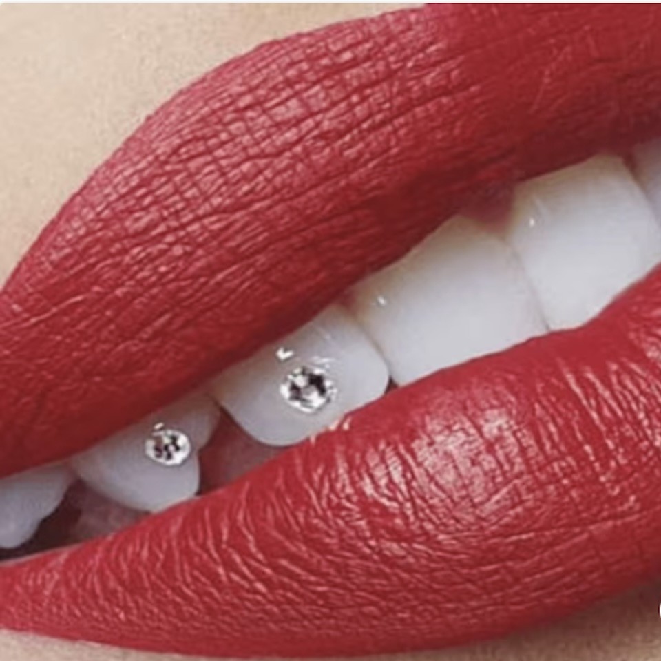 La popularité croissante des strass dentaires en 2024