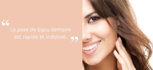 Strass Dentaire : Est-ce que ça fait mal ? (Douleur, Ressenti, Sécurité)